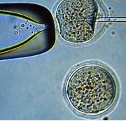 Cloning: perhaps stem cells aren't the easiest option.
