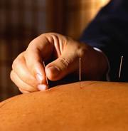 Studies in mice could shed light on whether acupuncture works in humans, some say.