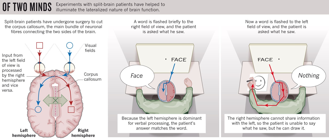 split brain patient case study