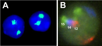 This two-panel photomicrograph shows chromosome territories visualized by fluorescence in situ hybridization. Panel A shows two blue circular liver nuclei on a black background. Within each nucleus there are two blotches of chromosome territories that are labeled in green. Panel B shows a cluster of three chromosomes, each labeled a different color, in a mouse lymphocyte nucleus. Chromosome 12 (red) is next to chromosome 14 (blue), which in turn is next to chromosome 15 (green). The second chromosome in each pair is located in a separate region of the nucleus.