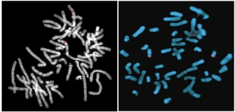 Two micrographs show FISH experimental results. Panel A shows red bands on two chromosomes in a spread of metaphase chromosomes, which appear as white and grey banded structures on a black background. In panel B, a FISH probe is used to map a breakpoint of a translocation. The chromosomes appear as blue and gray banded structures on a black background, and three chromosomes are marked with a red signal.