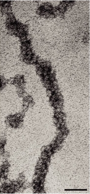 A black-and-white electron micrograph shows a 30-nanometer chromatin fiber. The fiber appears as a black, vertical, elongated tube against a light grey background. It starts in the upper left, curves toward the right, and then curves back and ends at the center bottom. Other short black tubes appear in the upper right and left middle and bottom.