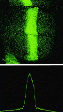 A multi-panel photomicrograph and distribution graph show the expression of DPP across a developing wing structure in a fruit fly. In the upper panel, green coloration represents GFP expression. The wing structure looks like a vague fluorescent green circular shape against a black background, with a thick, vertical green bar that spans from the top of the disc to the bottom.  GFP expression is more loosely distributed farther from the disc's center and looks like small green speckles. A line graph in the lower panel illustrates the pattern of GFP expression shown in the upper panel. The X-axis represents the diameter of the disc in the upper panel. The Y-axis represents the GFP intensity. The line exhibits a bell-curve shape; it peaks at the center, representing the high concentration of GFP at the center of the disc in the upper panel.