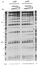 An electrophoresis gel shows the level of DNAse sensitivity in chromatin increases with an increasing concentration of the HSWI/SNF complex. The gel is separated into two halves: columns, or lanes, numbered one through seven, are classified as the minus ATP group. Lanes numbered eight through 14 are classified as the plus ATP group. The concentration of HSWI/SNF complex increases from left to right in each half, so that the concentration is lowest in lanes one and eight and highest in lanes seven and 14.