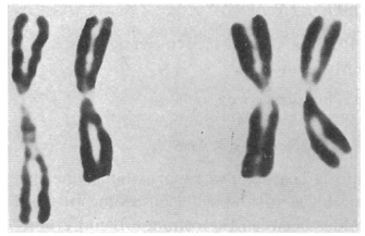 This micrograph shows two pairs of metaphase chromosomes, which appear as black, X-shaped objects against a light background. The left-most chromosome has a loose, extended region near the centromere. It is longer than the other three chromosomes, which have approximately the same length and shape.