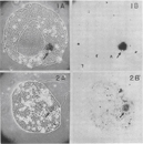 A photograph montage shows two columns of images: the left column (A) shows two photomicrographs of an amoeba with a radioactively-labeled nucleus transplant. The right column (B) shows two autoradiographs of the same amoeba shown in the left-hand column. The autoradiographs show the location of the radioactive material within the amoeba. The top image (labeled 1) in each column was taken shortly after the nucleus transplant occurred. The bottom image (labeled 2) in each column was taken at a later time point.