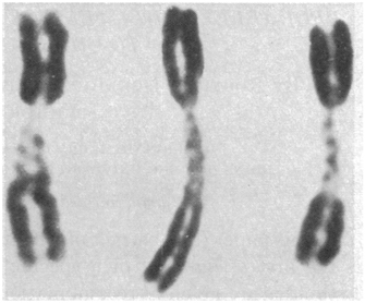 This micrograph shows three metaphase chromosomes, which appear as black, X-shaped objects against a light background. Each of the chromosomes has a loose, extended region near the centromere.