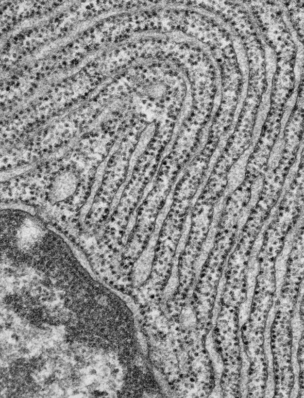 An electron micrograph shows the nucleus, endoplasmic reticulum, and ribosomes in a pancreatic cell. Only part of the cell is shown due to the large magnification of the image. A small portion of the round nucleus at the cell’s core is visible, and appears darker than the surrounding volume. The cell’s interior is filled with many parallel curved lines representing the endoplasmic reticulum (ER). The curved parallel folds of the ER membrane resemble the paths of a maze or many small black dots surround either side of the membrane folds; these are the ribosomes.