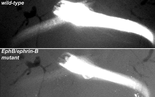 Two black and white photomicrographs show the paths of the retinal ganglion cell (RGC) axons in the retinas of wild-type and ephrin-B mutant mice. The RGC axons are labeled with dye and appear bright fluorescent white against a black or grey background. The top panel shows the RGC axons from a wild-type mouse. A faint collection of nerves branches off to the left from a very dense, thick trunk of nerves that starts in the center and extends with a slight downward curve to the right corner of the image. The bottom panel shows the RGC axons from an ephrin-B mutant mouse, and is labeled EphB/ephrin-B. The faint collection of nerves that branches off to the left in the wild-type mouse are absent in the ephrin-B mutant mouse. However, the thick trunk of nerves that extends to the right remains present.