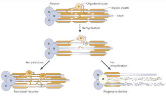 A schematic diagram shows two possible fates of demyelinated axons: the axons can either be remyelinated or they can become vulnerable to degradation. The diagram includes illustrations of neurons, oligodendrocytes, and myelin sheaths. Arrows separate the steps in these processes.