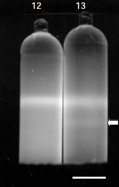 A gray-scale photograph shows two tubes of DNA separated by cesium chloride gradients. The sample on the left has only one visible band of DNA, while the sample on the right contains two DNA bands of varying densities. The tubes and bands are light grey on a black background.