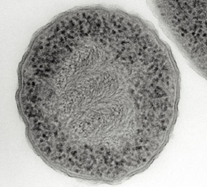 A grayscale photomicrograph shows a cross-section of a round bacterial cell.