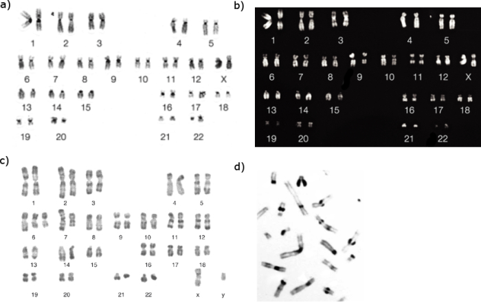 This four-panel montage shows the effects of four different staining techniques used to observe chromosomal structure. In panels A through C, the chromosome pairs are lined up in a karyotype. In panel D, the chromosomes are randomly scattered. Each staining technique results in chromosomes with different banding patterns.