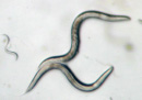 A photomicrograph shows three individuals from the nematode species C elegans. The worms are shown on a smooth, light grey surface. They are pointed at each end, and they have a dark grey outline with lighter shades of grey on their inner surfaces. At the center, two large, adult worms are curled into S-shapes, and the end of one adult worm is in contact with the middle of the other adult worm. A juvenile worm is present in the left hand side of the photo and is only one quarter the width and length of the two adult worms. It is also S-shaped.