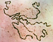 An electron micrograph shows a dark brown fruit fly chromosome against a pink background. The chromosome looks like a long, thin piece of string that has been tightly coiled. There are five long coils radiating out from a central point. The compact coils give the chromosome a banded, or striped, appearance.