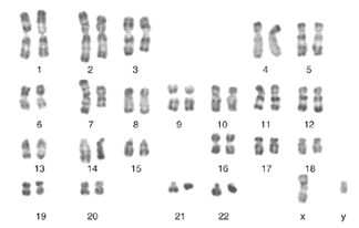 This karyotype depicts all 23 pairs of chromosomes in a human cell, including the sex-determining X and Y chromosomes that together make up the twenty-third set (lower right).
