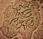 A photomicrograph from a light microscope shows chromosomes in a circular cell. The chromosomes, which resemble worms, have been condensed in preparation for cell division. The chromosomes are scattered randomly in the nucleus of the cell.
